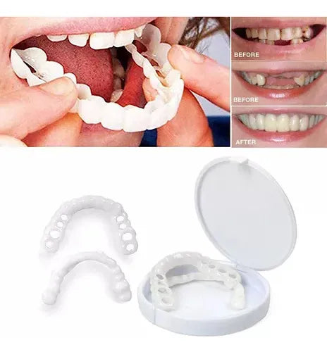 SnapSmile™ | Carillas Dentales