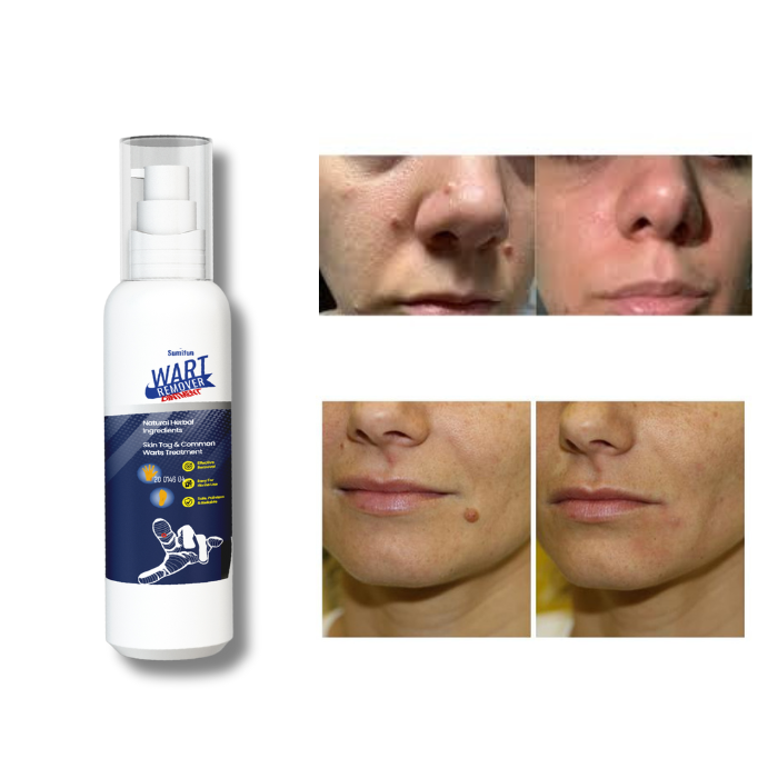 Dermiclear® - Piel clara y sana.